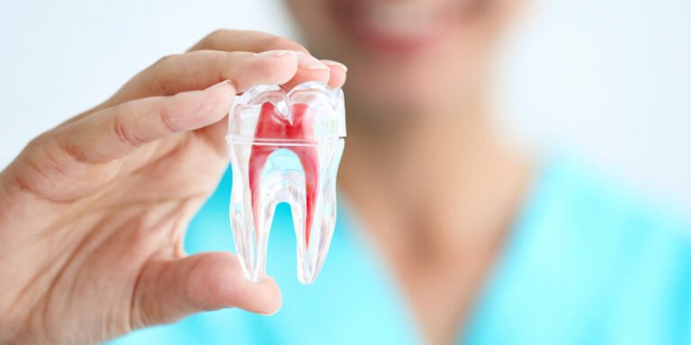 Root-Canal-Treatment in gurugram