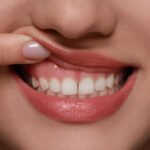 Gum Health Is the New Smile Trend