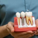 Best Implant Specialist in gurgaon