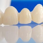 Dental Crowns in gurgaon