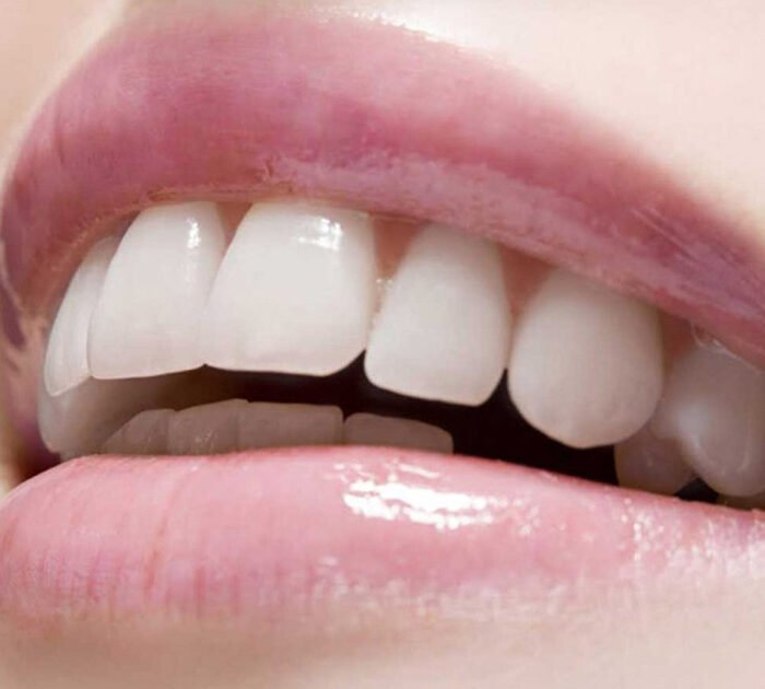 Smile Designing Clinic in Gurgaon