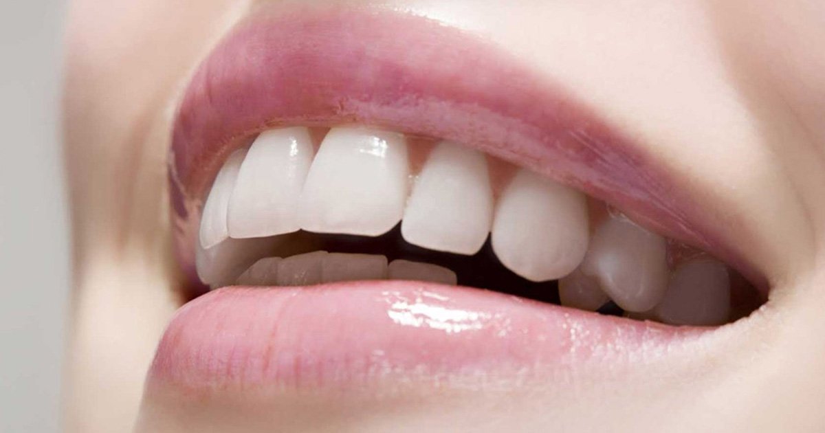 Smile Designing Clinic in Gurgaon