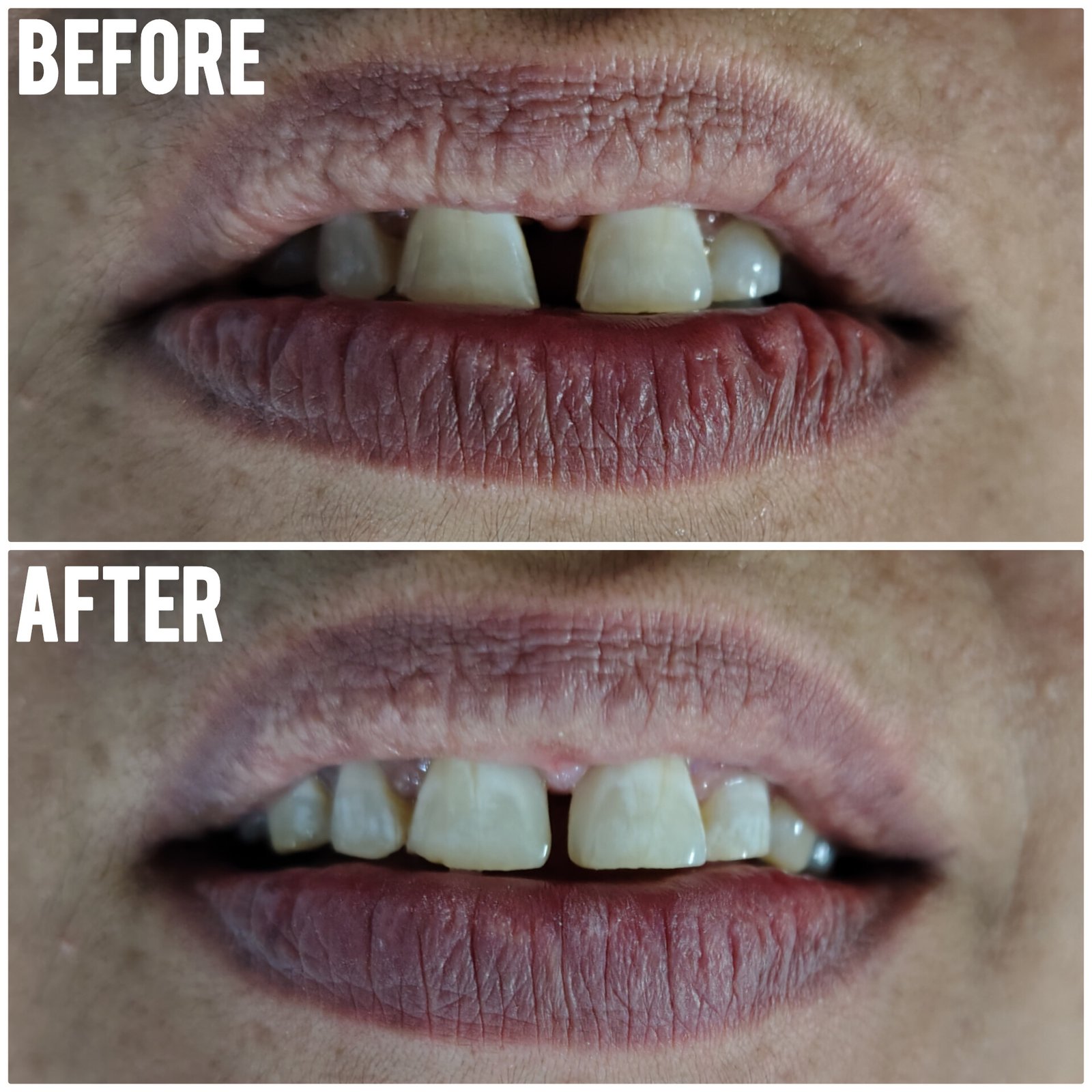 before after dental clinic treatment 4