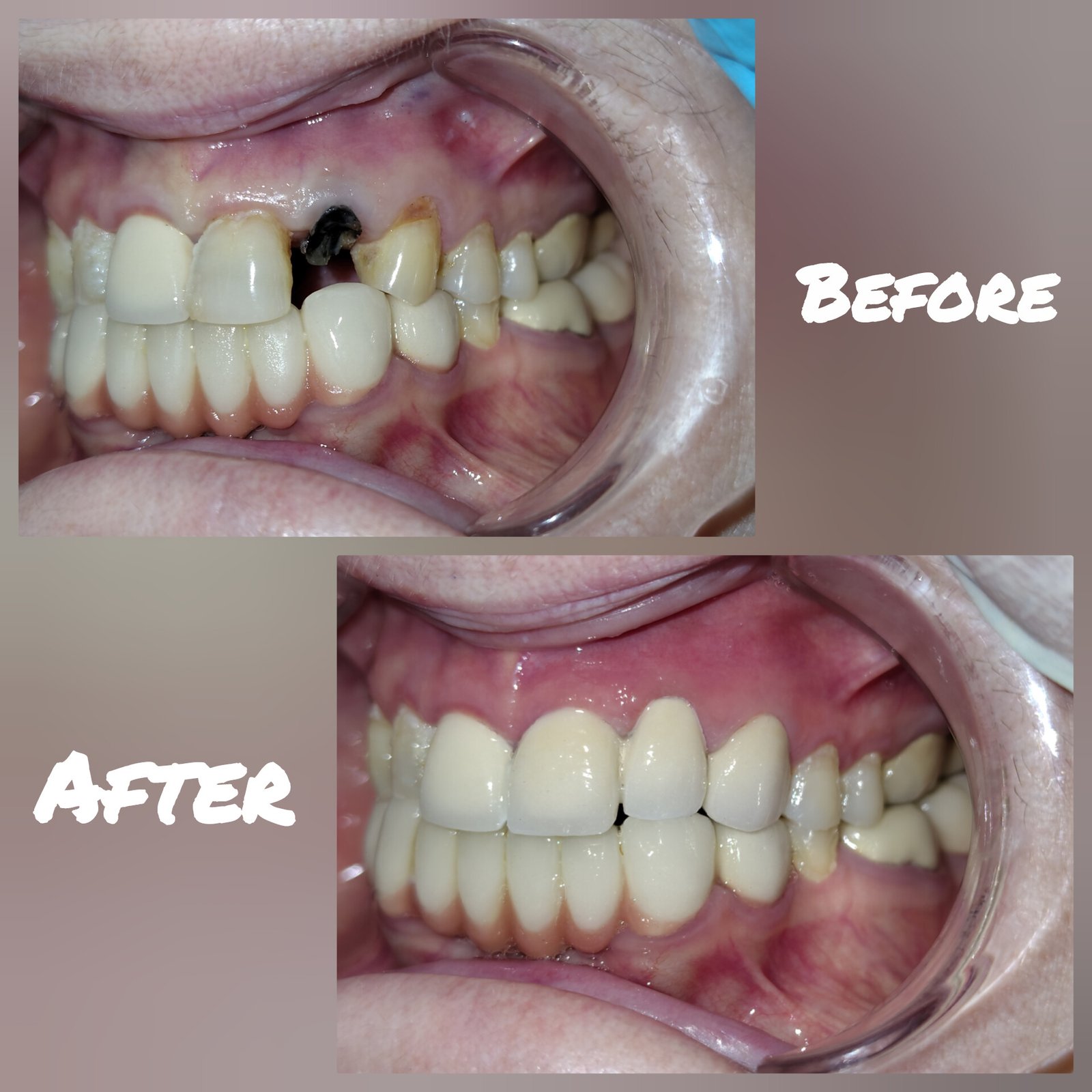 best dental clinic treatment before after case